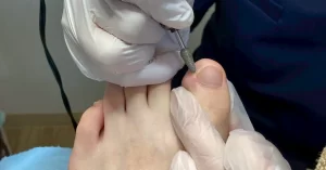 足の爪と角質ケア